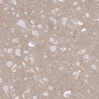 Anti-KCNH6 Antibody