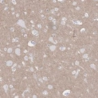 Anti-KCNH6 Antibody