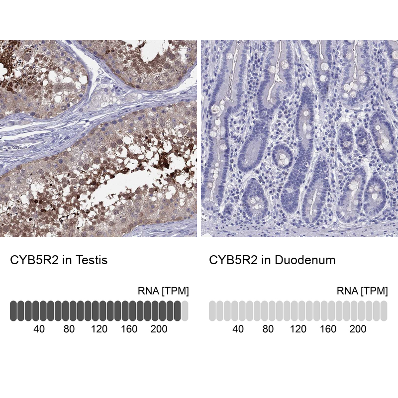 Anti-CYB5R2 Antibody