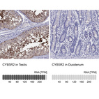 Anti-CYB5R2 Antibody