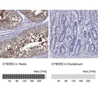 Anti-CYB5R2 Antibody