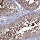 Immunohistochemical staining of human testis shows high expression.
