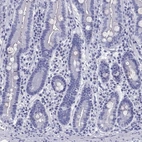 Immunohistochemical staining of human duodenum shows low expression as expected.