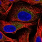 Immunofluorescent staining of human cell line U-2 OS shows localization to cytosol & mitochondria.