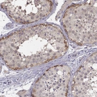 Immunohistochemical staining of human testis shows high expression.