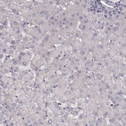 Immunohistochemical staining of human liver shows low expression as expected.