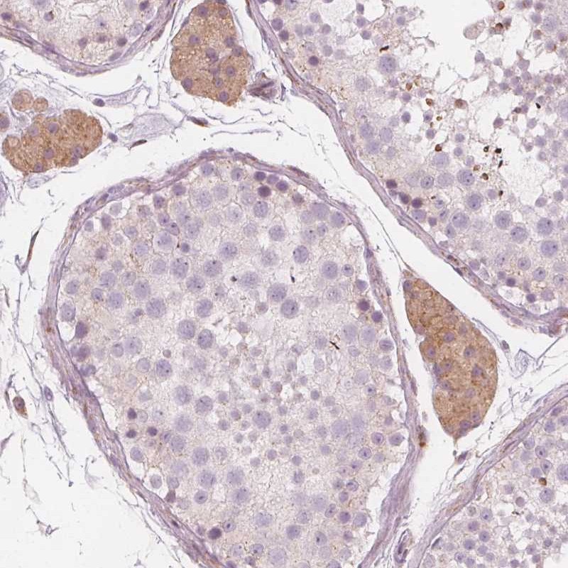 Anti-BRSK1 Antibody