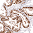 Anti-GREB1 Antibody