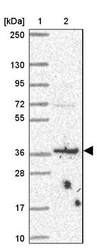 Lane 1: Marker [kDa] 250, 130, 95, 72, 55, 36, 28, 17, 10_br/_Lane 2: Human cell line RT-4