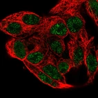 Immunofluorescent staining of human cell line Hep G2 shows localization to nucleoplasm.