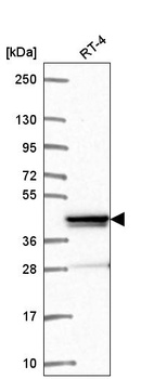Anti-ZNF618 Antibody
