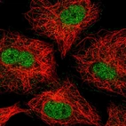 Immunofluorescent staining of human cell line A549 shows localization to nucleoplasm.