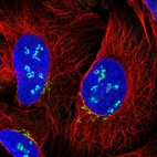 Anti-C12orf43 Antibody