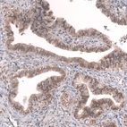 Immunohistochemical staining of human fallopian tube shows weak to moderate cytoplasmic and nuclear positivity in glandular cells.