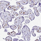 Immunohistochemical staining of human placenta shows moderate positivity in endothelial cells.