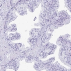 Immunohistochemical staining of human prostate shows no positivity in glandular cells as expected.