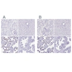 Immunohistochemical staining of human kidney, liver, placenta and prostate using Anti-LIN28B antibody HPA061745 (A) shows similar protein distribution across tissues to independent antibody HPA036630 (B).
