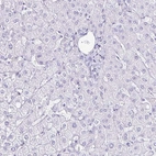 Immunohistochemical staining of human liver shows no positivity in hepatocytes as expected.