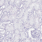 Anti-LIN28B Antibody
