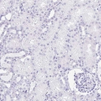 Immunohistochemical staining of human kidney shows no positivity in cells in tubules as expected.