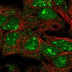 Immunofluorescent staining of human cell line HEK 293 shows localization to nucleus, nucleoli & cytosol.