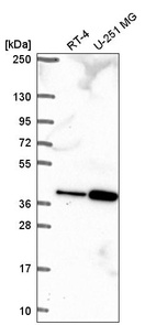 Anti-TPGS2 Antibody
