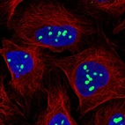 Immunofluorescent staining of human cell line U-2 OS shows localization to nucleoli.