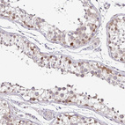 Anti-NUP188 Antibody