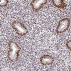 Anti-NUP188 Antibody