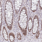 Immunohistochemical staining of human rectum shows moderate nuclear positivity in glandular cells.