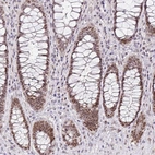Immunohistochemical staining of human rectum shows moderate nuclear positivity in glandular cells.