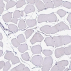 Immunohistochemical staining of human skeletal muscle shows no positivity in myocytes as expected.