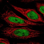 Immunofluorescent staining of human cell line SiHa shows localization to nucleoplasm.
