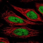 Anti-NUP188 Antibody