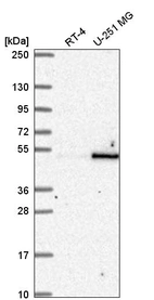 Anti-RBMS1 Antibody