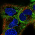 Immunofluorescent staining of human cell line A-431 shows localization to cytosol.