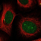 Anti-PSMB5 Antibody