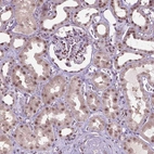 Anti-UBQLN4 Antibody