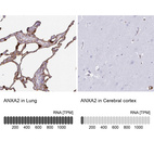 Anti-ANXA2 Antibody