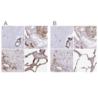 Immunohistochemical staining of human cerebral cortex, kidney, liver and lung using Anti-ANXA2 antibody HPA061798 (A) shows similar protein distribution across tissues to independent antibody HPA046964 (B).
