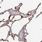 Immunohistochemical staining of human lung shows high expression.