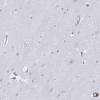 Immunohistochemical staining of human cerebral cortex shows low expression as expected.