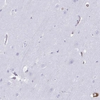 Immunohistochemical staining of human cerebral cortex shows low expression as expected.