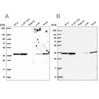 Western blot analysis using Anti-ANXA2 antibody HPA061798 (A) shows similar pattern to independent antibody HPA046964 (B).