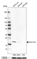 Anti-KIAA1143 Antibody