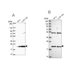 Anti-KIAA1143 Antibody