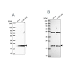 Western blot analysis using Anti-KIAA1143 antibody HPA061799 (A) shows similar pattern to independent antibody HPA045018 (B).