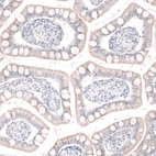 Immunohistochemical staining of human small intestine shows no positivity in glandular cells as expected.