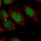 Immunofluorescent staining of human cell line SiHa shows localization to nucleus & cytokinetic bridge.
