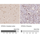 Anti-STK39 Antibody